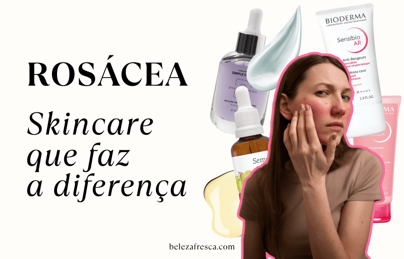 Imagem de mulher com rosácea e vários produtos de skincare que melhoram a rosácea