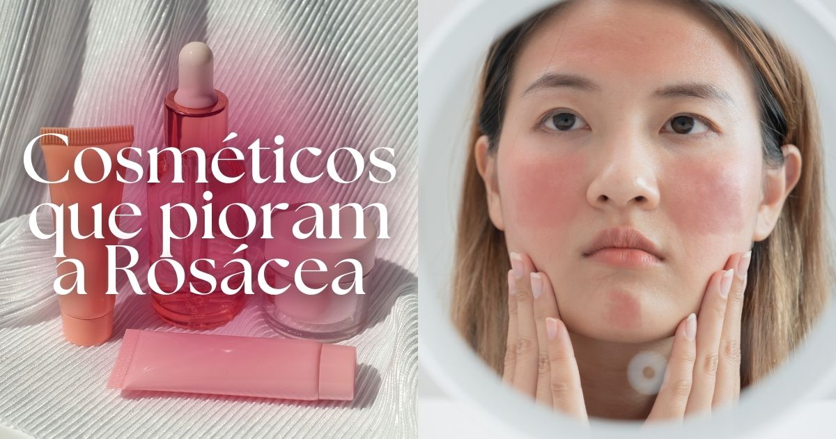 Imagem de pessoa com rosácea e produtos que pioram essa doença de pele